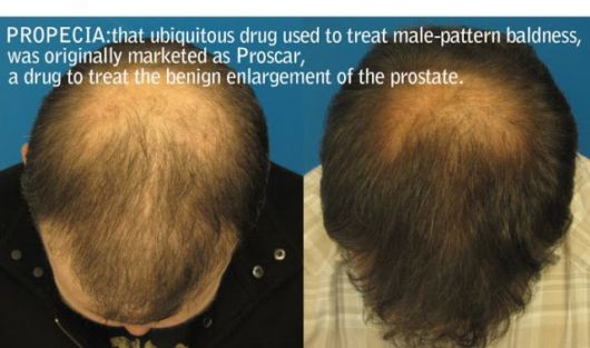 Things That Were Discovered Accidentally